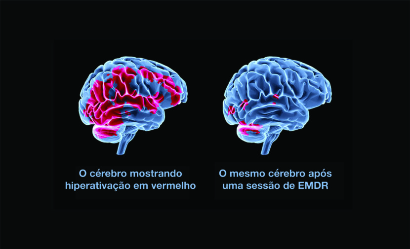 emdr antes e depois